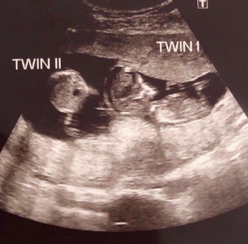 twins